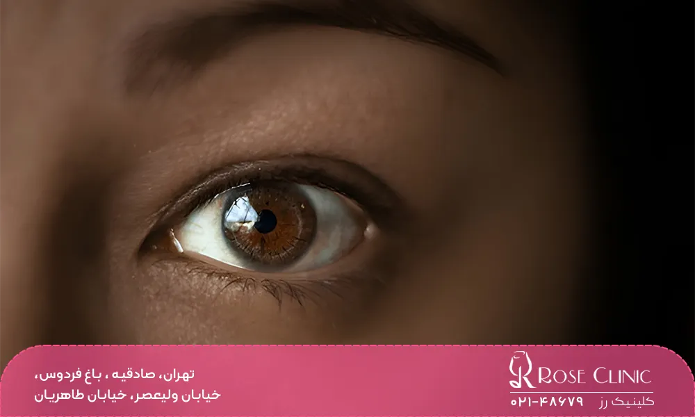 روش های کاشت ابرو و ارتباط آن با فصل