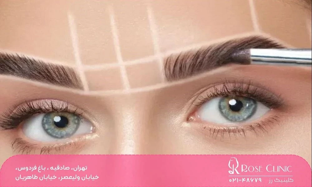 کاشت ابرو به روش 3d
