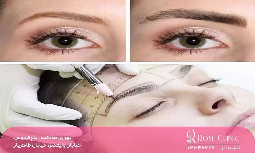 روش های کاشت ابرو