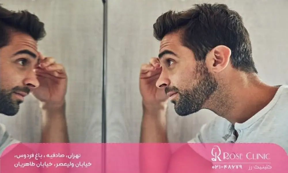 اجتناب از لمس بعد از کاشت ابرو