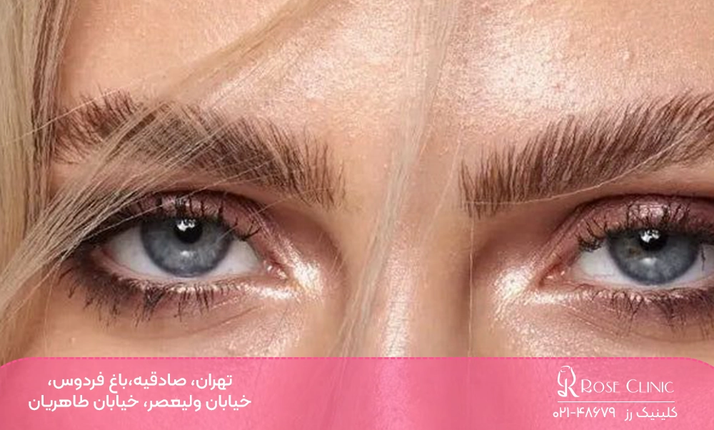لیفت ابروی کاشته شده قهوه ای 