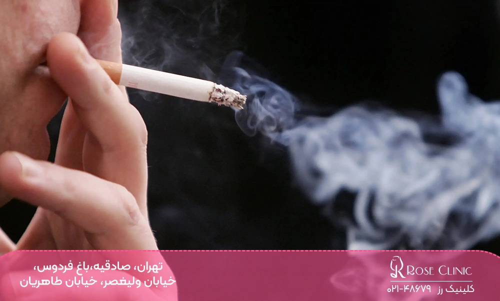 سیگار کشیدن بعد از کاشت مو