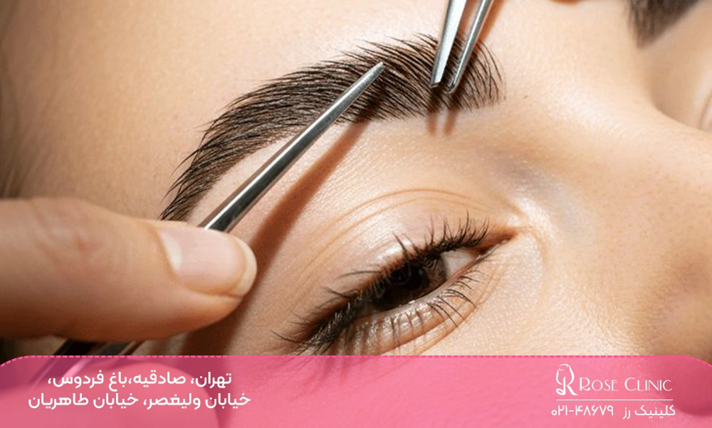 کاشت ابرو مدل ابرو پهن