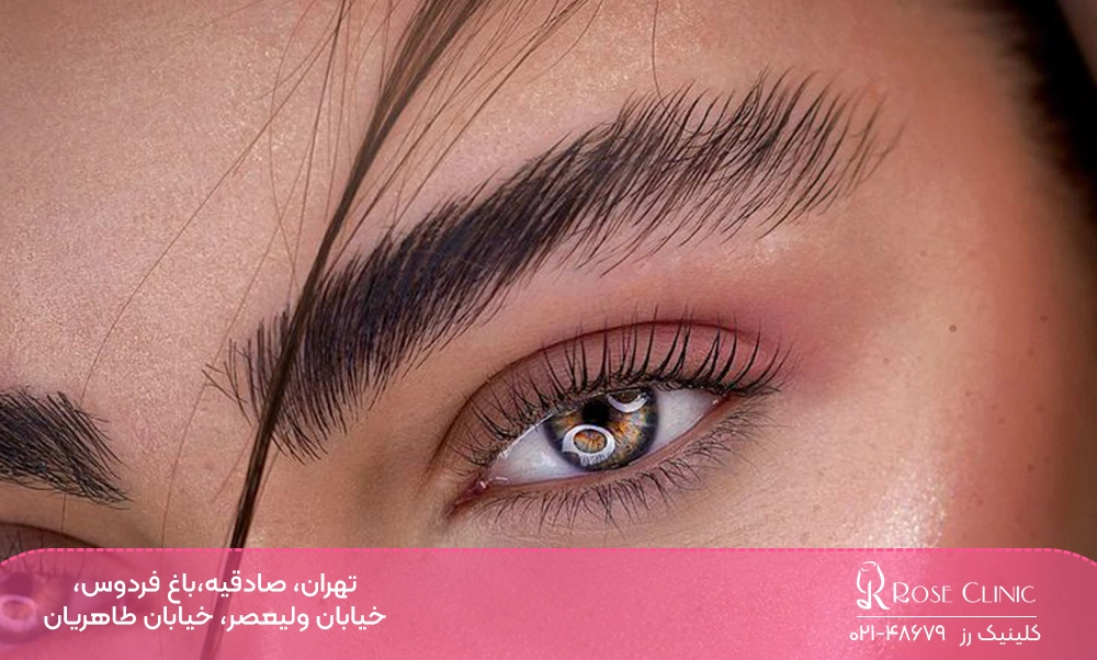 لیفت ابروی کاشته شده در یک خانم چشم رنگی