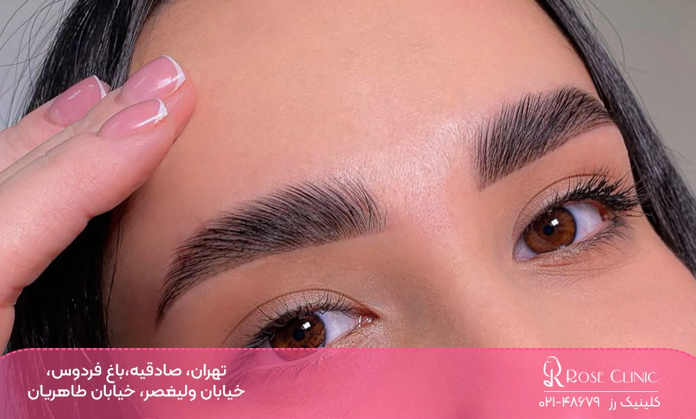 چند ماه بعد از کاشت مدل ابرو پهن