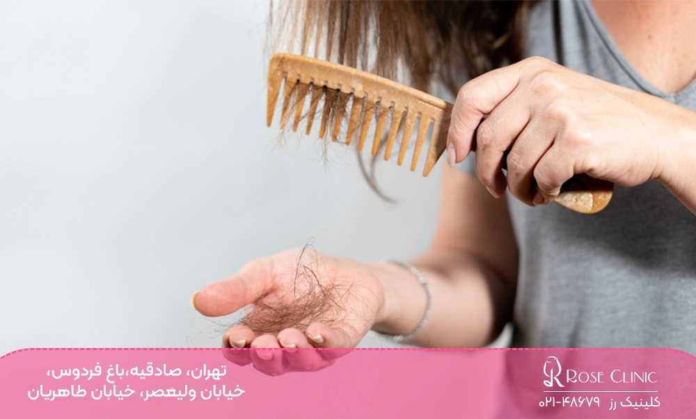 ریزش مو در خانم ها