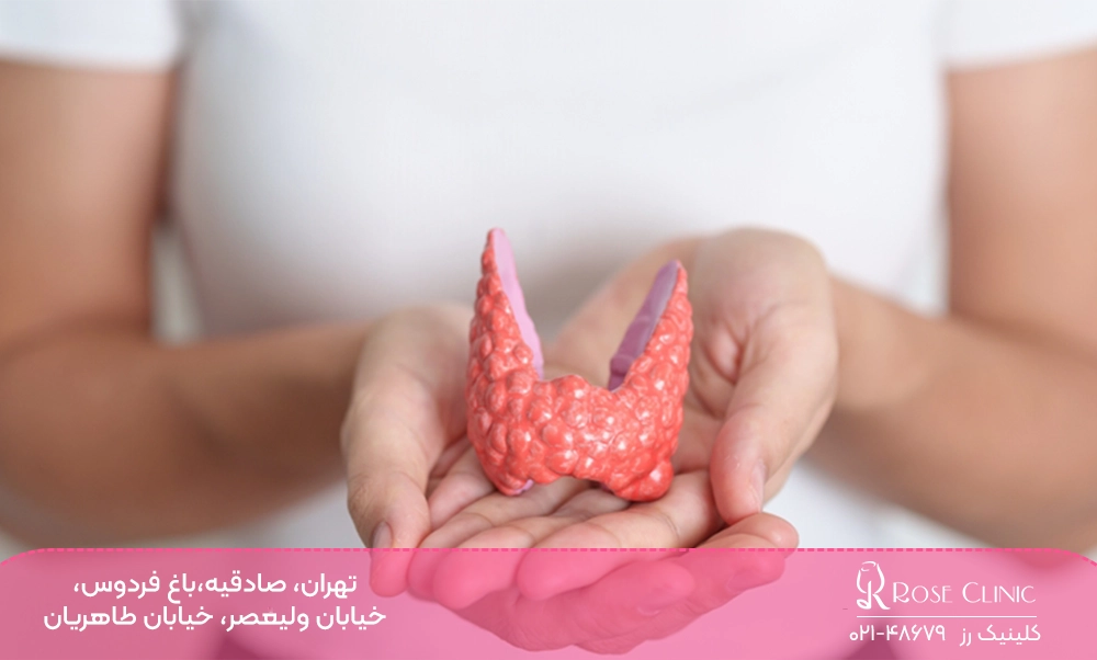 کم کاری تیروئید و کاشت مو