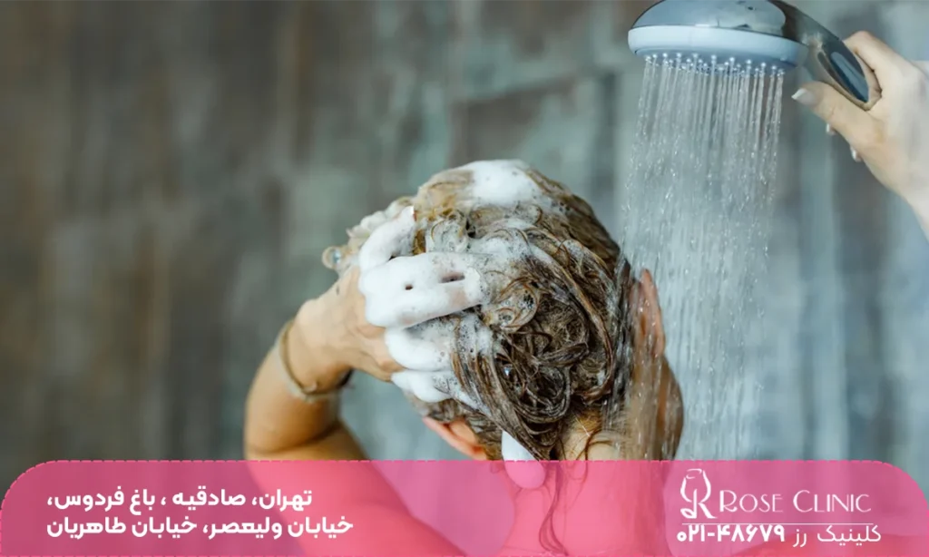 دوش گرفتن و ریزش مو