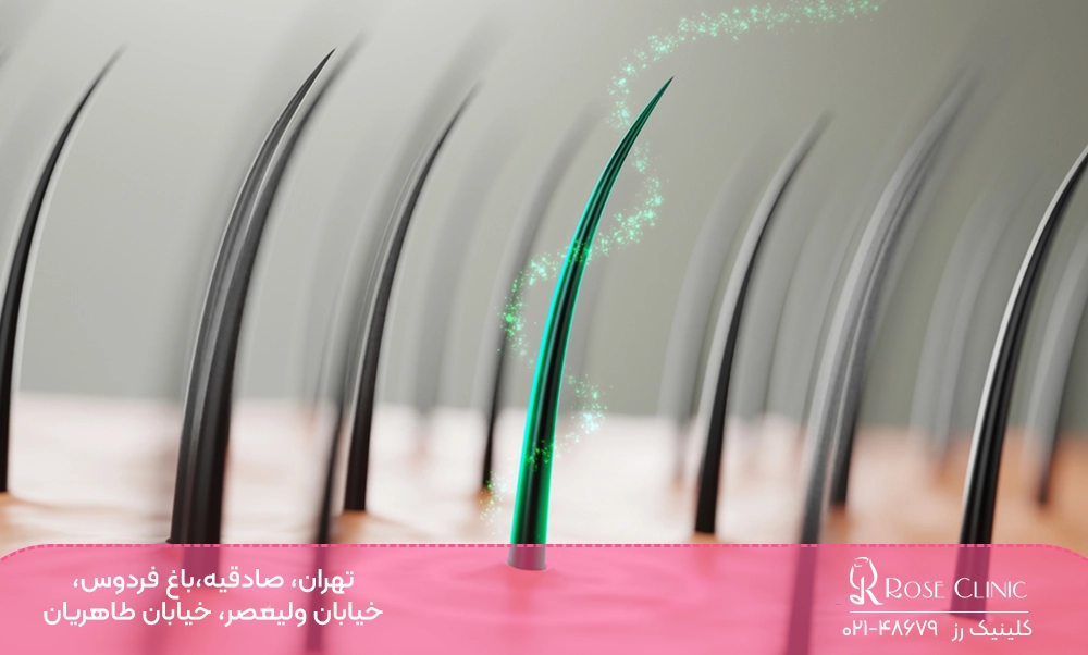 کاشت مو با روش کاشت مو در دنیا