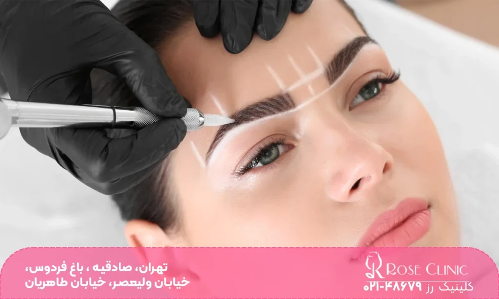 مراحل اولیه یبل از کاشت ابرو | فیبروز ابرو بعد از کاشت