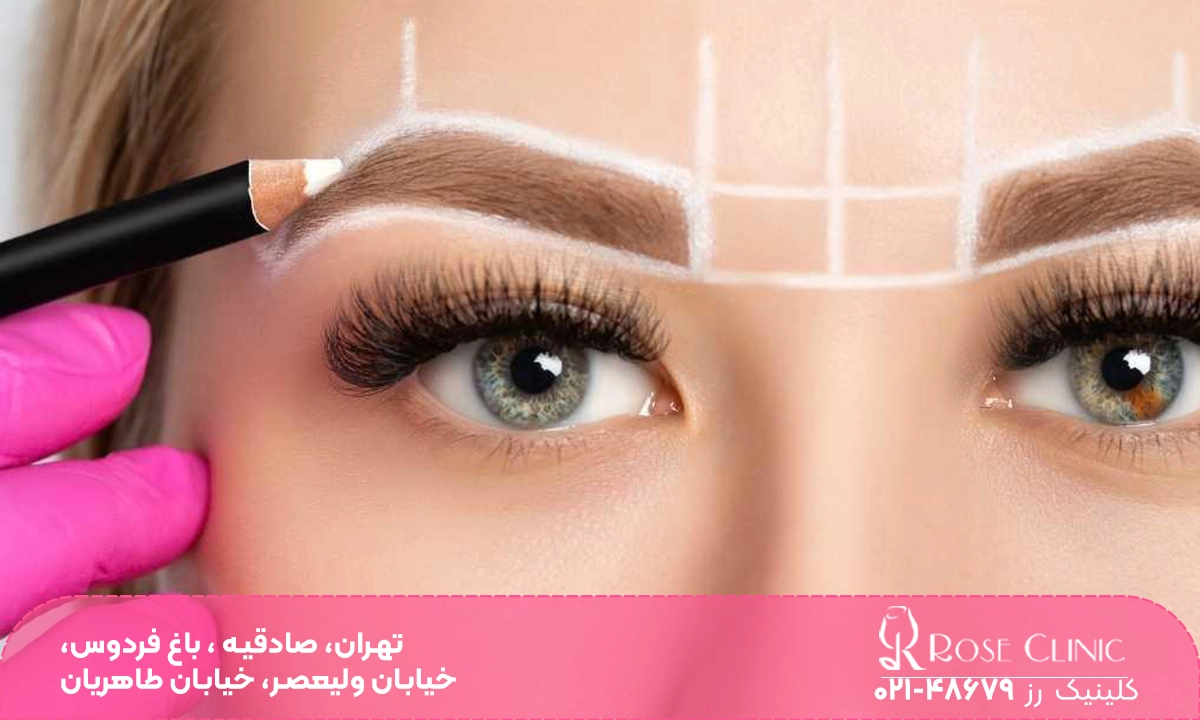 فیبروز ابرو بعد از کاشت