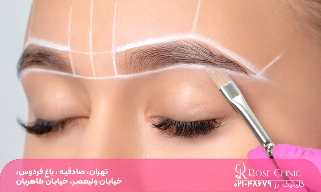 عکس زدن ژل ابرو بعد از کاشت ابرو