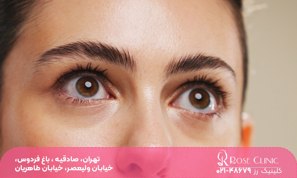 رشد ابرو بعد از کاشت