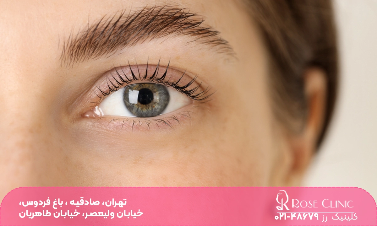 رشد ابرو بعد از کاشت