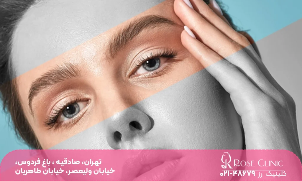 عکس هاشور ابرو بعد از کاشت