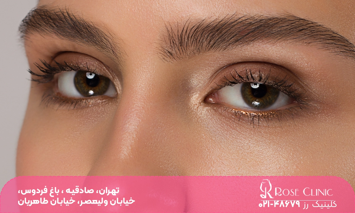 شکل هاشور ابرو بعد از کاشت