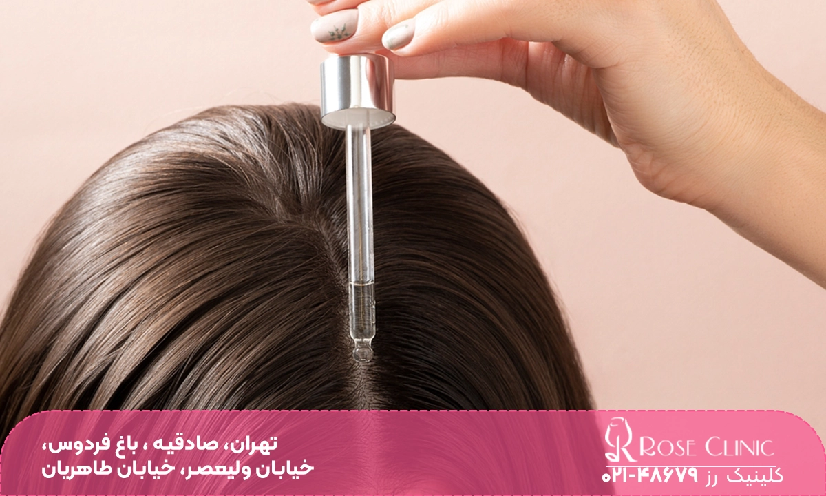 مصرف ماینوکسیدیل برای تقویت مو و جلوگیری از ریزش