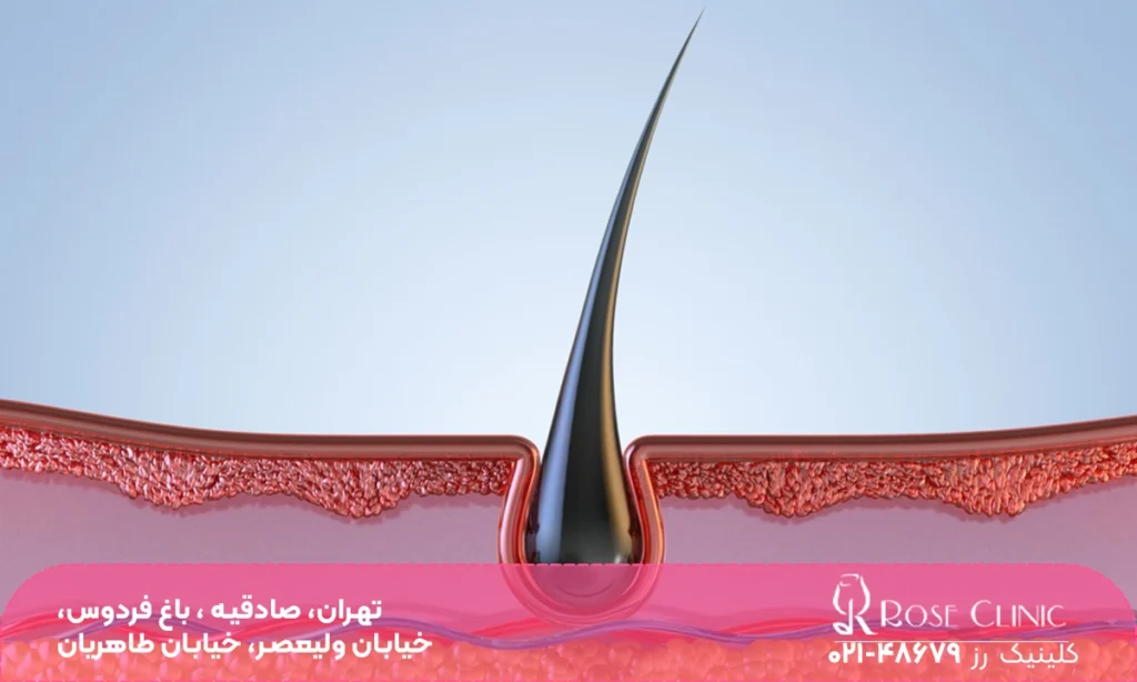 عکس پیاز مو