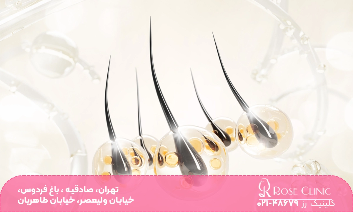 شکل پیاز مو