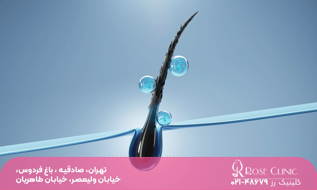 تصویر پیاز مو